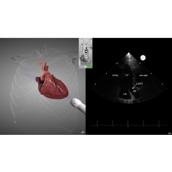 E-Learning : Introduction à l'Echocardiographie Transthoracique ETT