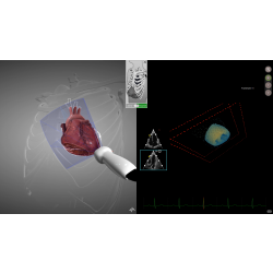 HeartWorks 3D module