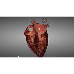HeartWorks Module E-Learning –  Cours d'Echocardiographie transthoracique destiné aux Echographistes