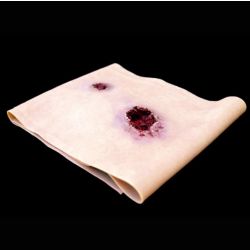 Blessure par balle à la jambe