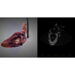 E-Learning : Introduction à l'Echocardiographie Transoesophagienne ETO