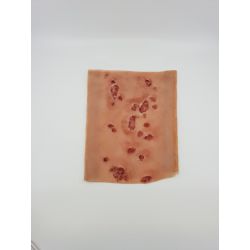 Manchon pour plaies diabétiques à la jambe