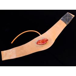 Neck Wound