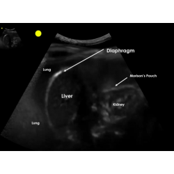 BodyWork Module E-Learning (Point-of-Care Ultrasound) 