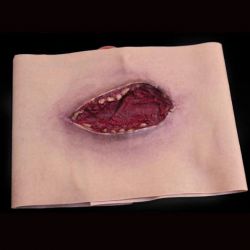 Lésion par lacération à la cuisse