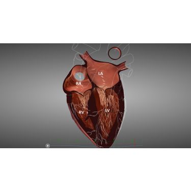 HeartWorks Module E-Learning –  Cours d'Echocardiographie transthoracique destiné aux Echographistes