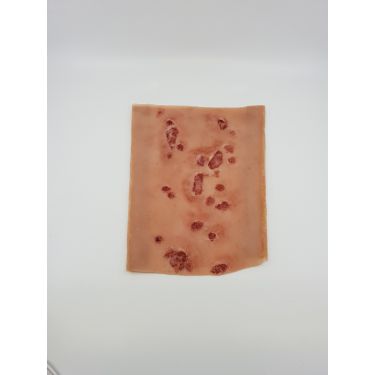 Manchon pour plaies diabétiques à la jambe