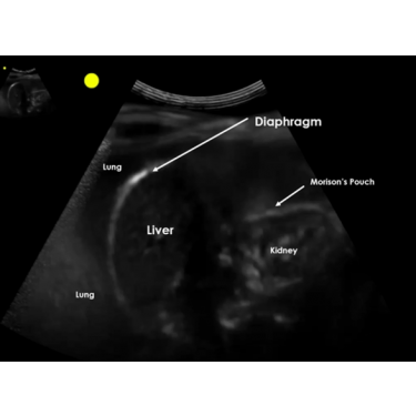 BodyWork Module E-Learning (Point-of-Care Ultrasound) 