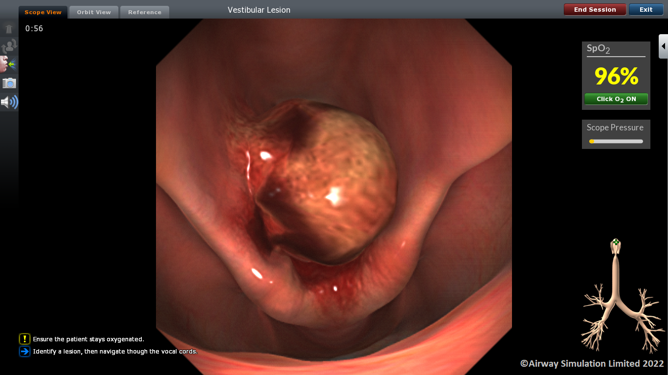 März-Aktion : ORSIM Bronchoskopie Simulator 